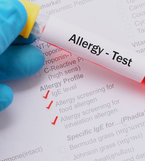 Allergens testing Arizona