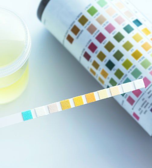 Bacteria testing Arizona